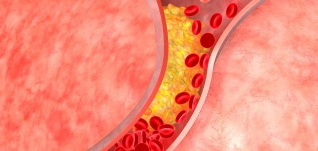 طبيبة: لا يوجد في الطب مفهوم 