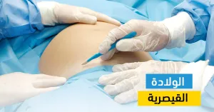 كل ما تود الأمهات معرفته عن الولادة القيصرية والخرافات المتعلقة بها